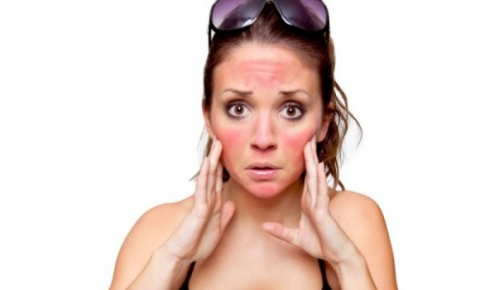 Tổn thương da do nắng và cách hồi phục hiệu quả