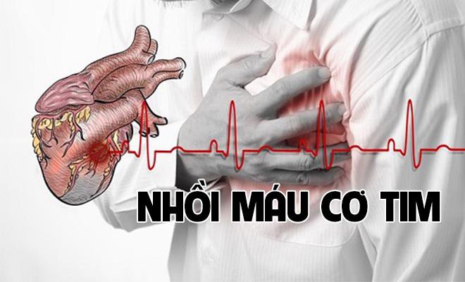 Nhồi máu cơ tim - Một biến chứng nguy hiểm